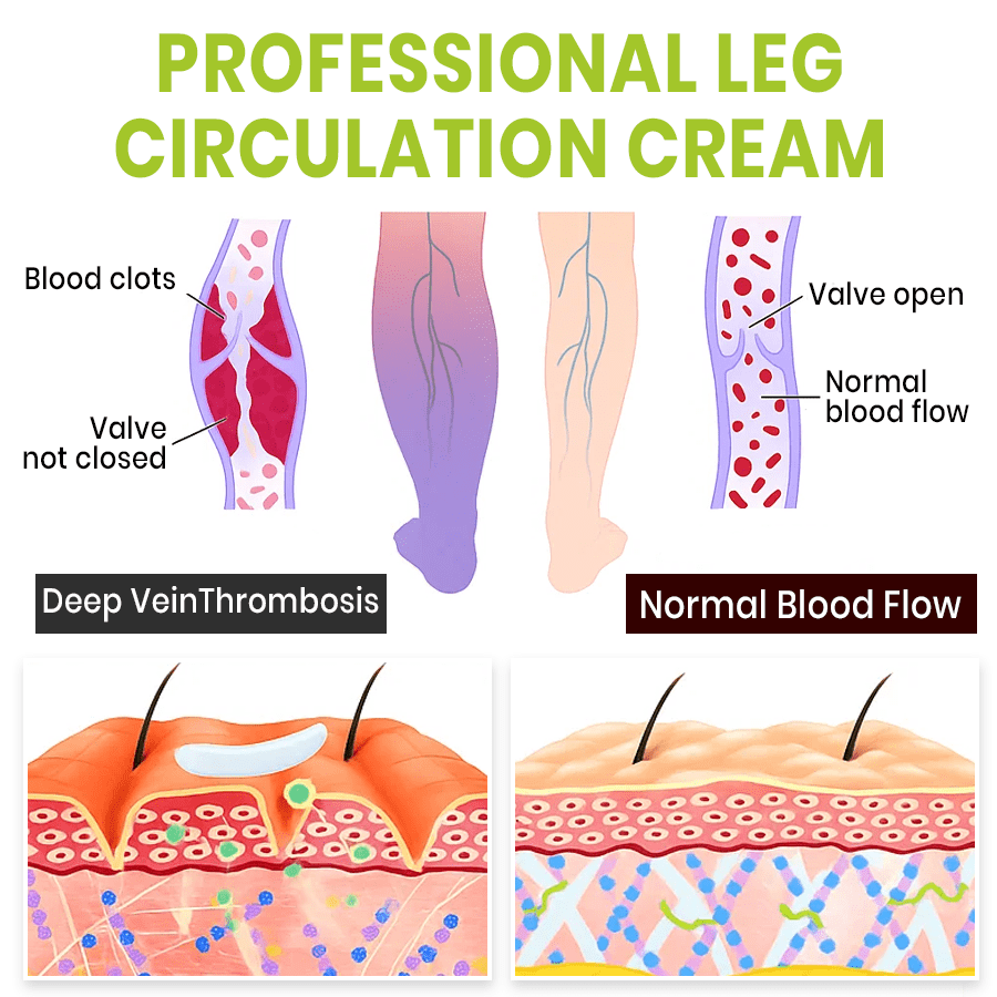NEENCE® Professional Leg Circulation Cream_Ultra02