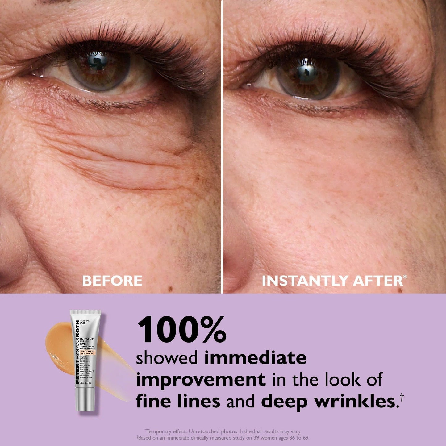 55% OFF 🪄No-Filter Eye Tightener（副本）