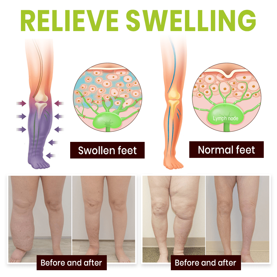 NEENCE® Professional Leg Circulation Cream_Ultra02