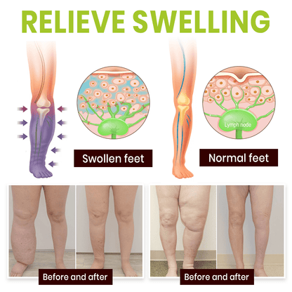 NEENCE® Professional Leg Circulation Cream_Ultra02