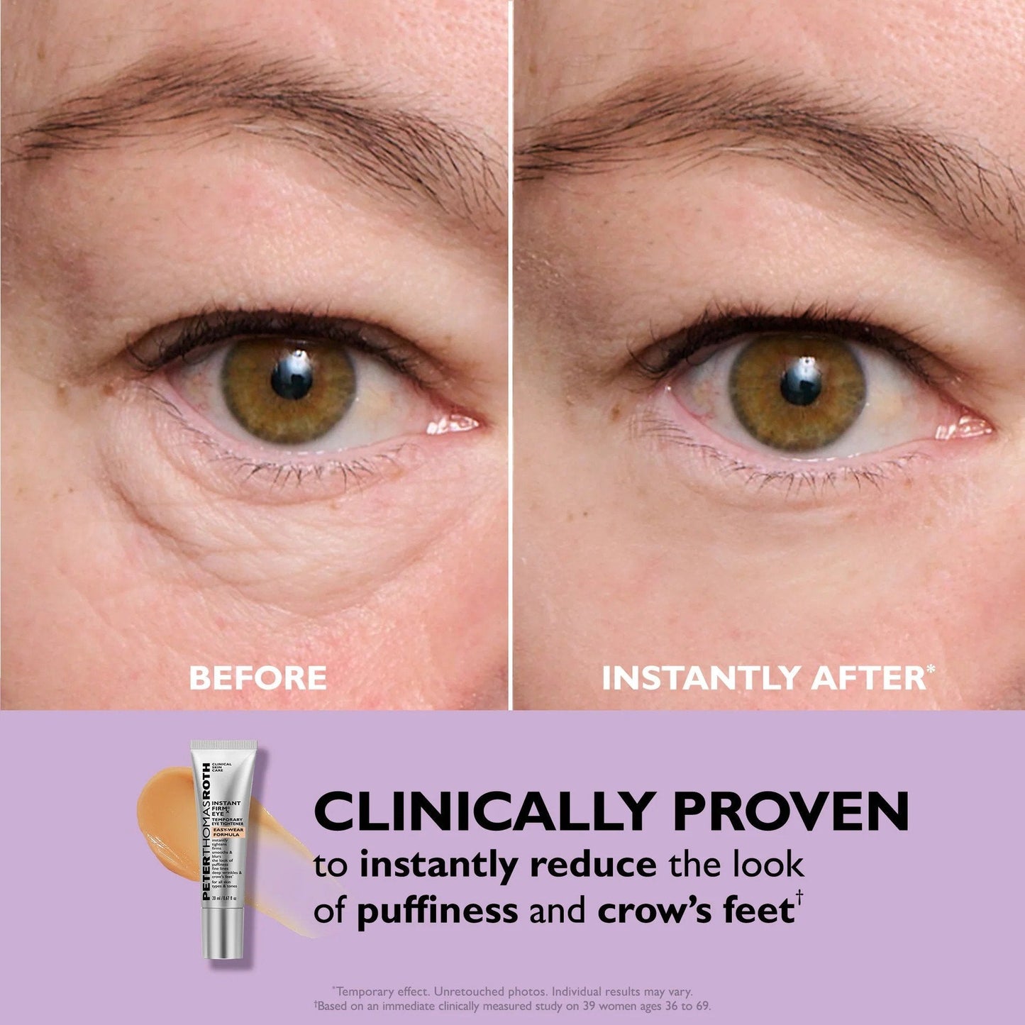 55% OFF 🪄No-Filter Eye Tightener（副本）