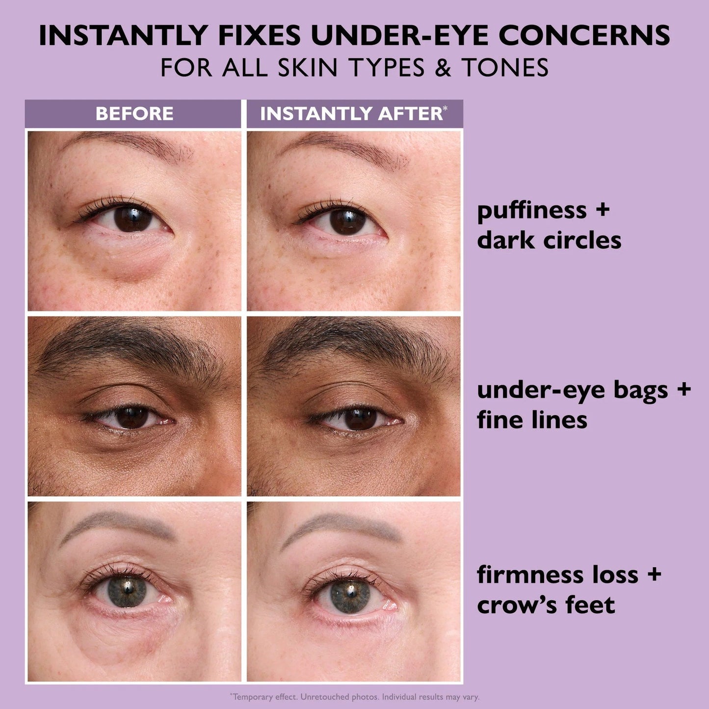 55% OFF 🪄No-Filter Eye Tightener（副本）